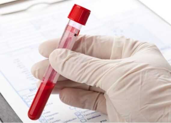 Con i metodi diagnostici di laboratorio è possibile identificare microflora o virus patologica
